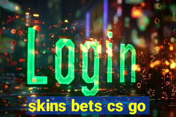 skins bets cs go