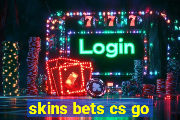 skins bets cs go