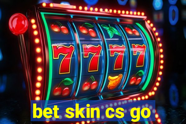 bet skin cs go