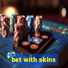 bet with skins