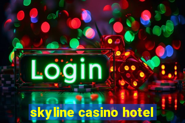 skyline casino hotel